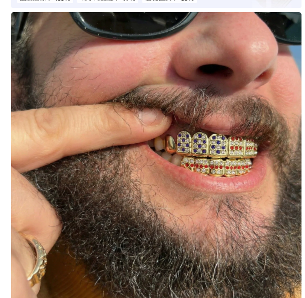 Model wearing gold-tone red, white and blue six-tooth grillz set
